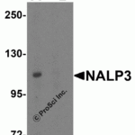 Western blot analysis of NALP3 in K562 cell lysate with NALP3 antibody at 1 μg/mL (A) in the absence and (B) in the presence of blocking peptide.