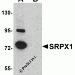 Western blot analysis of SRPX1 in SK-N-SH cell lysate with SRPX1 antibody at 0.25 μg/mL in (A) the absence and (B) the presence of blocking peptide.