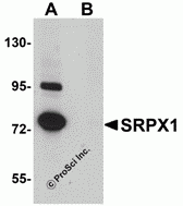 SRPX1 Peptide