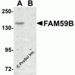 Western blot analysis of FAM59B in SK-N-SH cell lysate with FAM59B antibody at 1 μg/mL in (A) the absence and (B) the presence of blocking peptide.