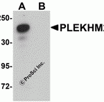 Western blot analysis of PLEKHM2 in rat brain tissue lysate with PLEKHM2 antibody at 0.5 μg/mL in (A) the absence and (B) the presence of blocking peptide.