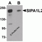 Western blot analysis of SIPA1L2 in rat brain tissue lysate with SIPA1L2 antibody at 1 μg/mL in (A) the absence and (B) the presence of blocking peptide.