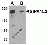 SIPA1L2 Peptide
