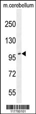 ADAMTS10 Antibody