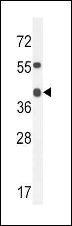 ADH4 Antibody