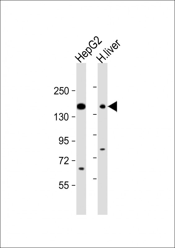 ABCC3 Antibody