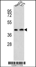 AADAT Antibody