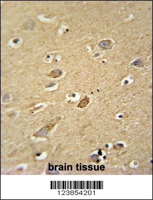 ATP5H Antibody