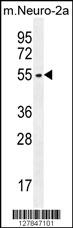 ZDHHC1 Antibody