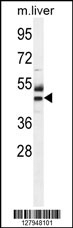 ATPBD3 Antibody