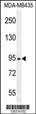 ZBBX Antibody