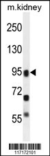 ALOXE3 Antibody