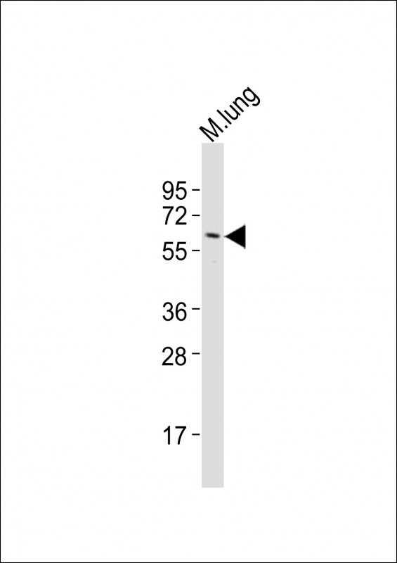 ANGPT1 Antibody