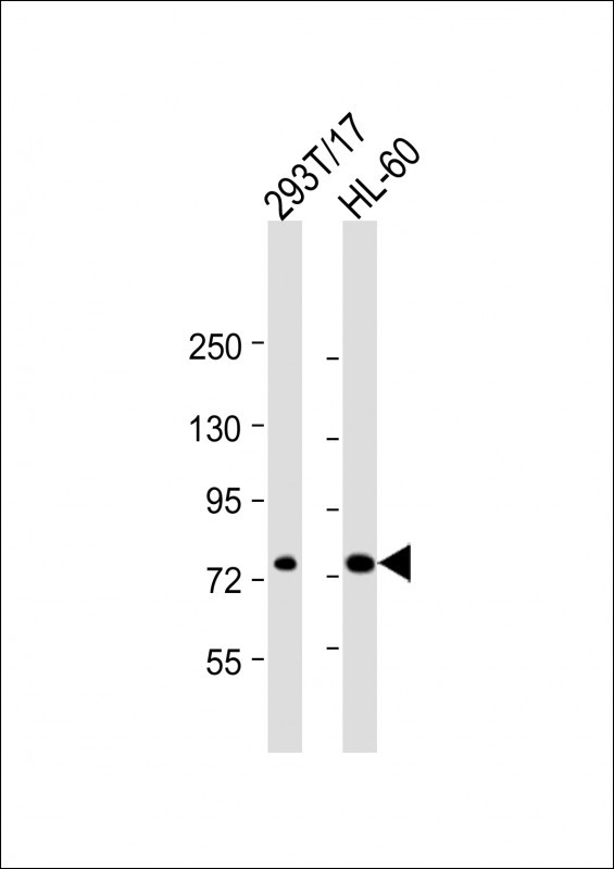 ABCD1 Antibody