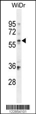 BCMO1 Antibody