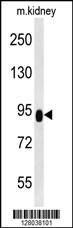 ZBTB41 Antibody