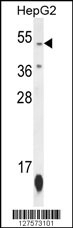 ZNF566 Antibody