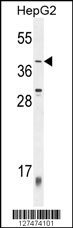 ZNF763 Antibody