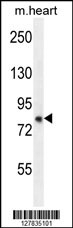 ZFYVE28 Antibody