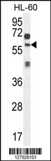 ZSWIM1 Antibody