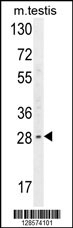 YDJC Antibody