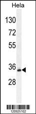 BCKDHB Antibody