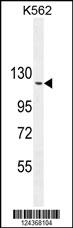 ARHGAP17 Antibody