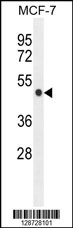 ZNF454 Antibody