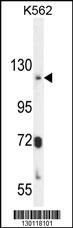 ATP8A2 Antibody