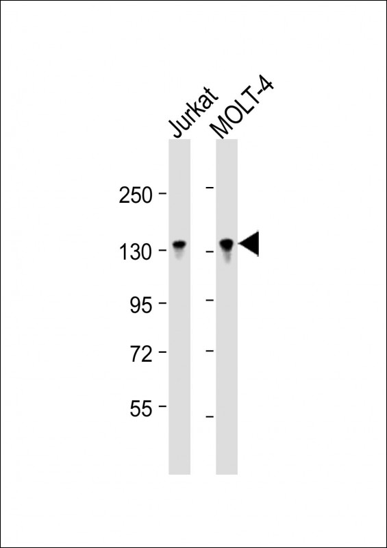 BCL11B Antibody