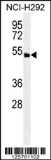 ABHD8 Antibody