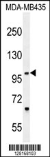 ZNF512B Antibody