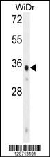 WDR5B Antibody