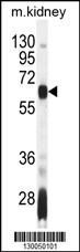 AIRE Antibody