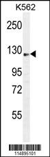AASS Antibody