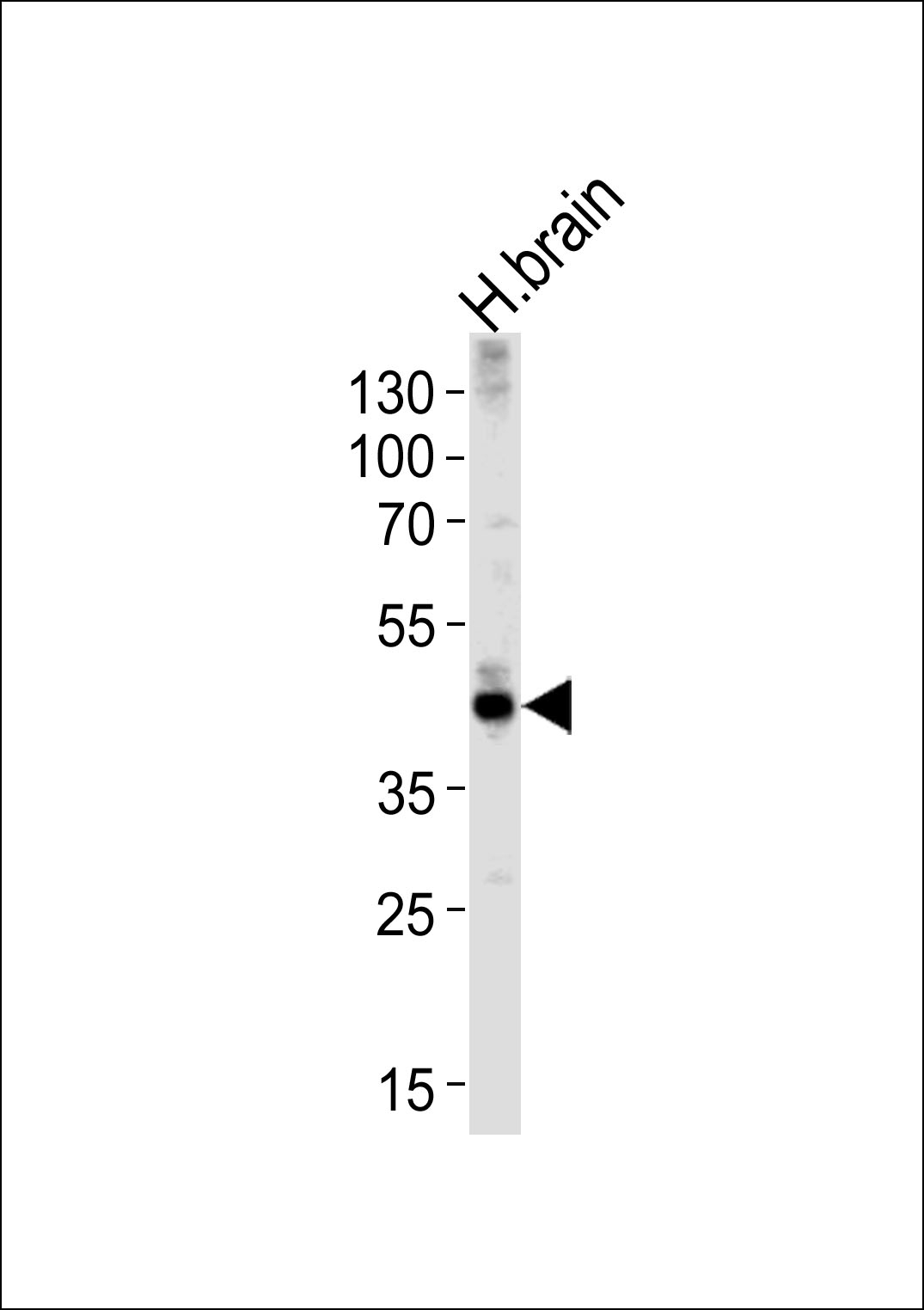 ALDOC Antibody
