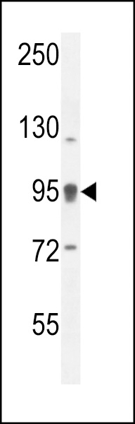 ACAP1 Antibody