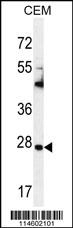 TIMP1 Antibody