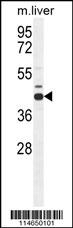 AHCY Antibody