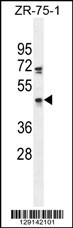 ZNF578 Antibody