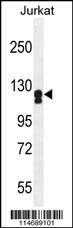 ADCY2 Antibody