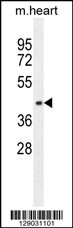 AP1M1 Antibody