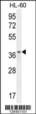 ZNF322B Antibody