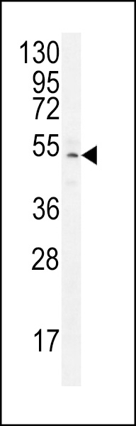 ZNF829 Antibody