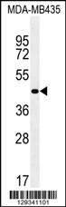 ZNF625 Antibody