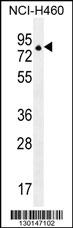 ZNF28 Antibody