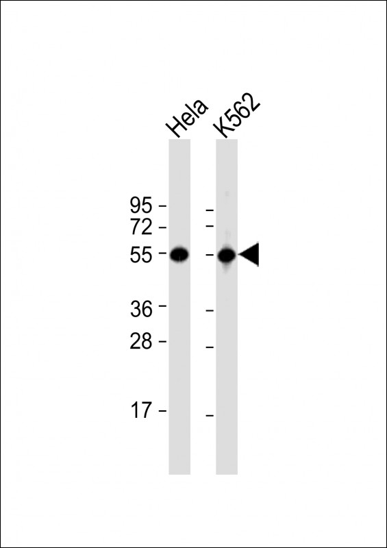 ATP6V1B1 Antibody