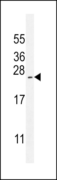 ARL17P1 Antibody