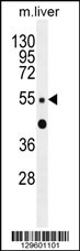 ZNF672 Antibody