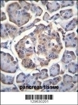 BTBD17 Antibody